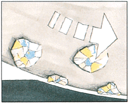 Bild 1: Freilegung des Diamanten bei Bearbeitung des Materials...