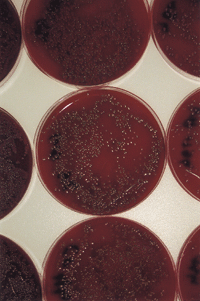 Die Absicherung der PCR-Methodik, um mit Sicherheit sagen zu können, lebende Organismen beprobt zu haben, erfolgte mittels klassischer Mikrobiologie.