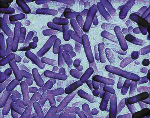 Bild 5: Legionellen unter dem Mikroskop.