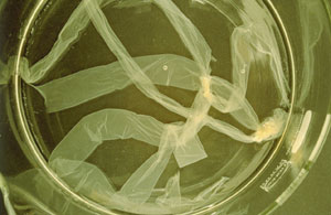 Bild 4: Schlauchartiger Biofilm, der sich in einer Reinstwasseranlage von PVC-Rohren gelöst hat.