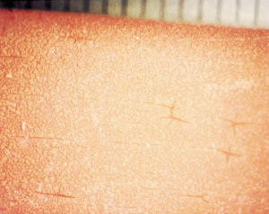 Durch Abbau und Zerfall der Kunststoffe (Korrosion/Dilaboration) bewirkte Zerstörung von Warmwasserleitungsrohren und -fittings aus Trinkwasserhausinstallationen nach einer Lebensdauer von 10 bzw. 15 Jahren unter üblichen Bedingungen. Die Bilder zeigen die Rohr- und Fittinginnenansichten. Die Abstände der Randstriche betragen 1 mm.