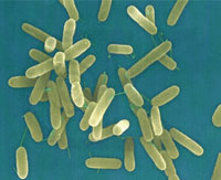 Mikrobiologische Herausforderung